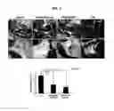 Fig. 03 - Pharmaceutical composition for preventing or treating rheumatoid arthritis, containing rebamipide