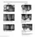 Fig. 02 - Androgen receptor antagonists and uses thereof