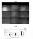 Fig. 03 - COMPOSITION COMPRISING VITAMIN U AS ACTIVE INGREDIENT FOR HEALING SKIN WOUND
