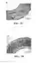 Fig. 03 - Extrusion of a Foamable Fluoropolymer