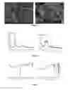 Fig. 02 - Metal cyanide complex catalyst and its preparation and application
