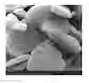 Fig. 01 - Carrier for silver catalyst, its preparation, a silver catalyst made from the same and its use