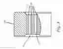 Fig. 12 - Impeller housing for percutaneous heart pump