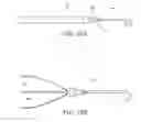 Fig. 17 - Impeller housing for percutaneous heart pump