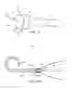 Fig. 22 - Impeller housing for percutaneous heart pump