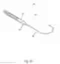 Fig. 30 - Impeller housing for percutaneous heart pump