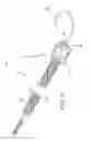 Fig. 31 - Impeller housing for percutaneous heart pump