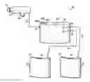 Fig. 01 - Heart assist system
