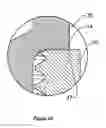 Fig. 15 - Medical implant system