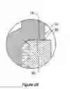 Fig. 16 - Medical implant system