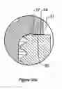 Fig. 17 - Medical implant system