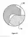 Fig. 19 - Medical implant system