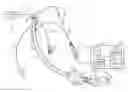 Fig. 01 - Multi-lumen tracheal tube with visualization device