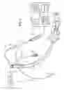 Fig. 02 - Multi-lumen tracheal tube with visualization device