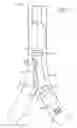 Fig. 03 - Multi-lumen tracheal tube with visualization device