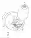 Fig. 04 - Multi-lumen tracheal tube with visualization device