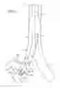 Fig. 09 - Multi-lumen tracheal tube with visualization device
