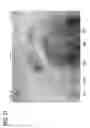 Fig. 33 - Assembly with Imaging Electronics