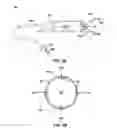 Fig. 06 - Implantable medical device fixation