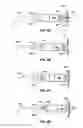 Fig. 07 - Implantable medical device fixation
