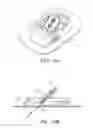 Fig. 17 - Transcutaneous analyte sensor