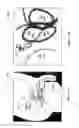 Fig. 37 - Radioactive-emission-measurement optimization to specific body structures