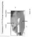 Fig. 46 - Radioactive-emission-measurement optimization to specific body structures