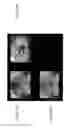 Fig. 47 - Radioactive-emission-measurement optimization to specific body structures