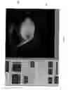 Fig. 49 - Radioactive-emission-measurement optimization to specific body structures