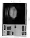 Fig. 50 - Radioactive-emission-measurement optimization to specific body structures