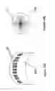 Fig. 55 - Radioactive-emission-measurement optimization to specific body structures