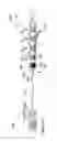 Fig. 58 - Radioactive-emission-measurement optimization to specific body structures