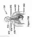 Fig. 63 - Radioactive-emission-measurement optimization to specific body structures