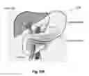 Fig. 64 - Radioactive-emission-measurement optimization to specific body structures