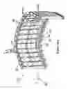 Fig. 77 - Radioactive-emission-measurement optimization to specific body structures