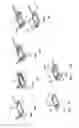 Fig. 97 - Radioactive-emission-measurement optimization to specific body structures