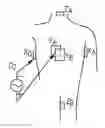 Fig. 01 - Dynamic adaptive respiration compensation with automatic gain control