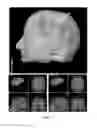 Fig. 03 - Method of rapidly visualizing essential neural pathways