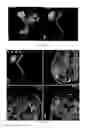 Fig. 22 - Method of rapidly visualizing essential neural pathways