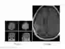 Fig. 23 - Method of rapidly visualizing essential neural pathways