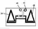 Fig. 01 - Injectable Vascular Access Port with Discernable Markers for Identification