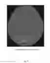Fig. 04 - METHOD OF CT ANGIOGRAPHY TO VISUALIZE TRANS-OSSEOUS BLOOD VESSELS
