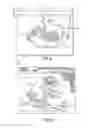 Fig. 04 - AUTOMATIC IDENTIFICATION OF INTRACARDIAC DEVICES AND STRUCTURES IN AN INTRACARDIAC ECHO CATHETER IMAGE