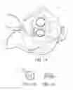 Fig. 02 - Oxygen mask