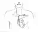 Fig. 01 - Systems and methods for using electrical impedance for neuro cardiac therapy