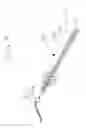 Fig. 10 - ACCESS CATHETER SYSTEM HAVING A PRECISELY POSTIONABLE NEEDLE TIP