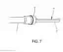Fig. 05 - Surgical instrument for molecular sampling