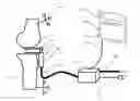 Fig. 01 - DEVICE AND METHOD OF AUTOMATIC CALIBRATION OF A TENSOR IN ARTHROPLASTY PROCEDURES