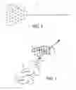 Fig. 02 - DURABLE ELECTRODE CONSTRUCTION FOR AN ORTHOTIC DEVICE
