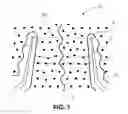 Fig. 08 - Reinforced therapeutic wrap and method